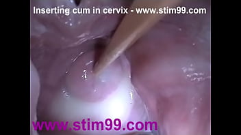 cervix nurse