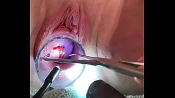 urethal insertion