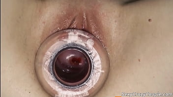 extreme ugly anal