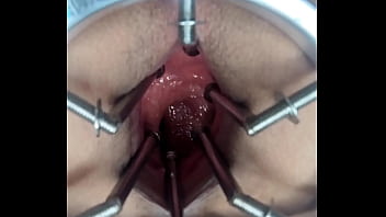 urethra insertion nurse